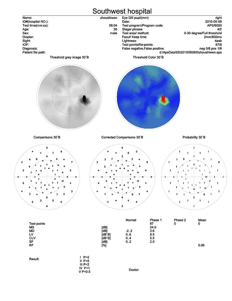 China Manufacture Good Quality Ophthalmic Perimeter