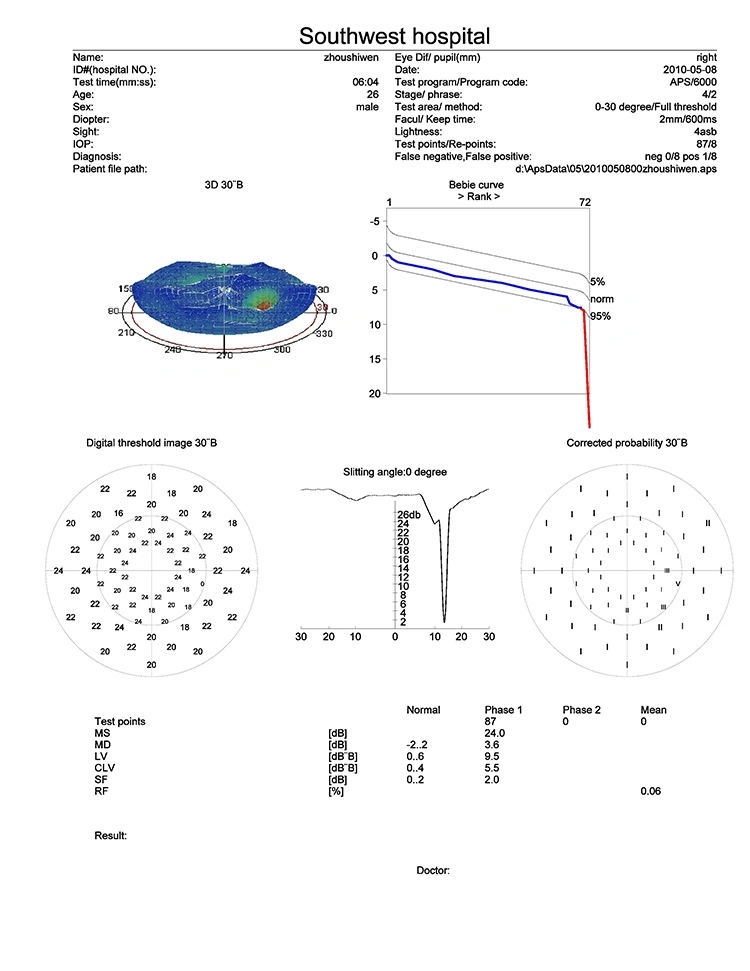 China Manufacture Good Quality Ophthalmic Perimeter