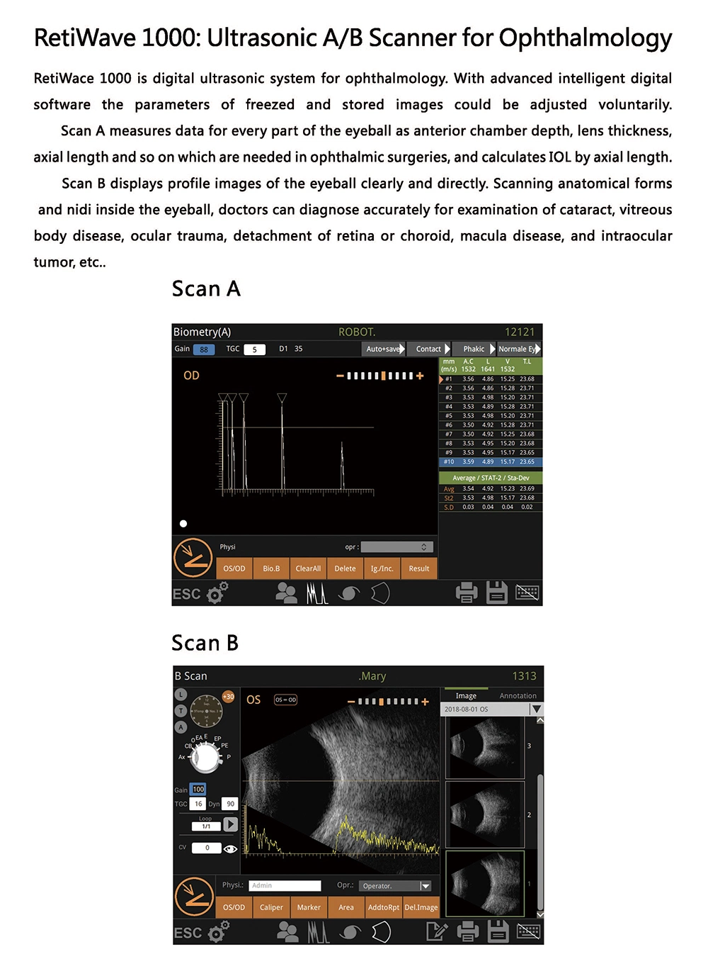 Retiwave 1000 Ophthalmic Medical Ultrasonic A/b Scanner For Ophthalmology Of Best Price